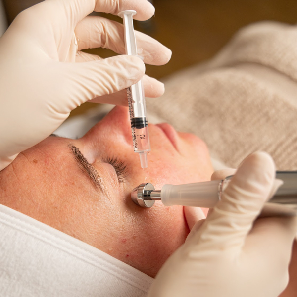 Periocular, Detox. Tratamientos Faciales Estética